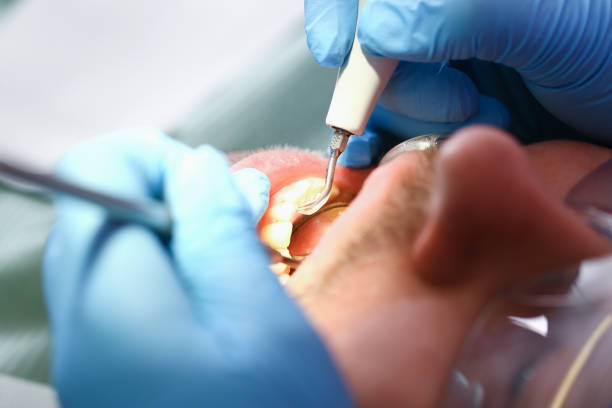 Best Emergency Cosmetic Dentistry in Elkhorn, CA