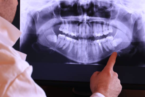 Best Emergency Dental Services for Seniors in Elkhorn, CA