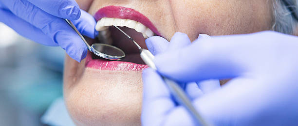 Best Holiday Emergency Dentist in Elkhorn, CA